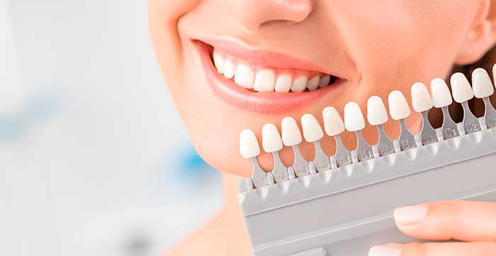 Blanqueamiento Dental